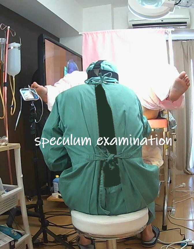 5speculum examination